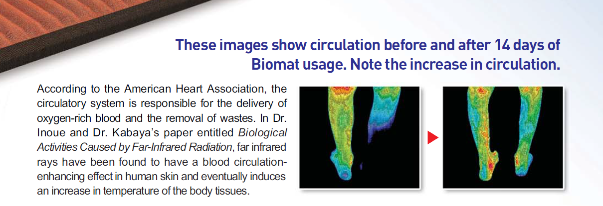 Thermal image comparison of feet showing circulation before and after 14 days of Biomat® far infrared therapy.