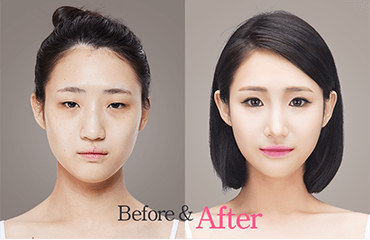 Image from a South Korean plastic surgeon's website