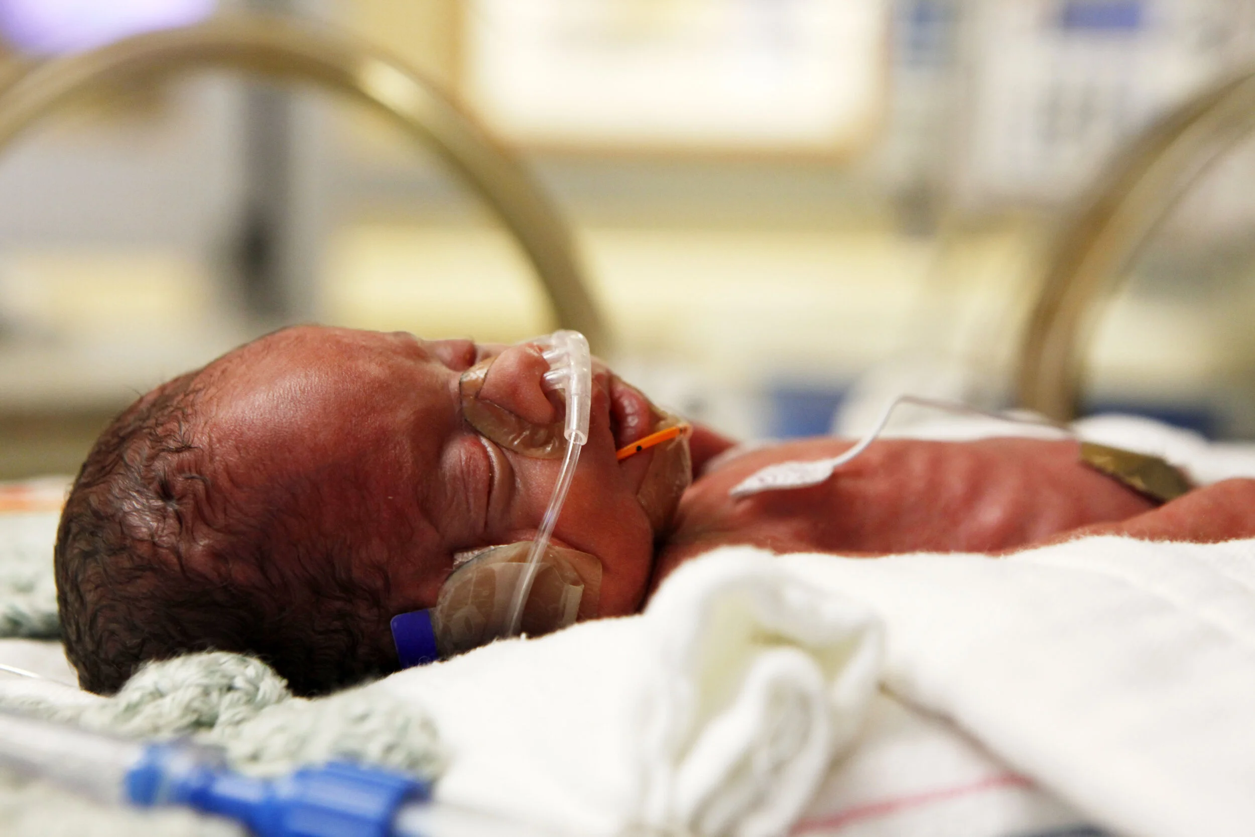 Lyric Fox is seen in the neonatal intensive care unit at Porter Regional Hospital on Jan. 15, 2020 in Liberty Township. Fox weighed 2 pounds and 2 ounces when he was born premature. He was a little over 14 inches long.