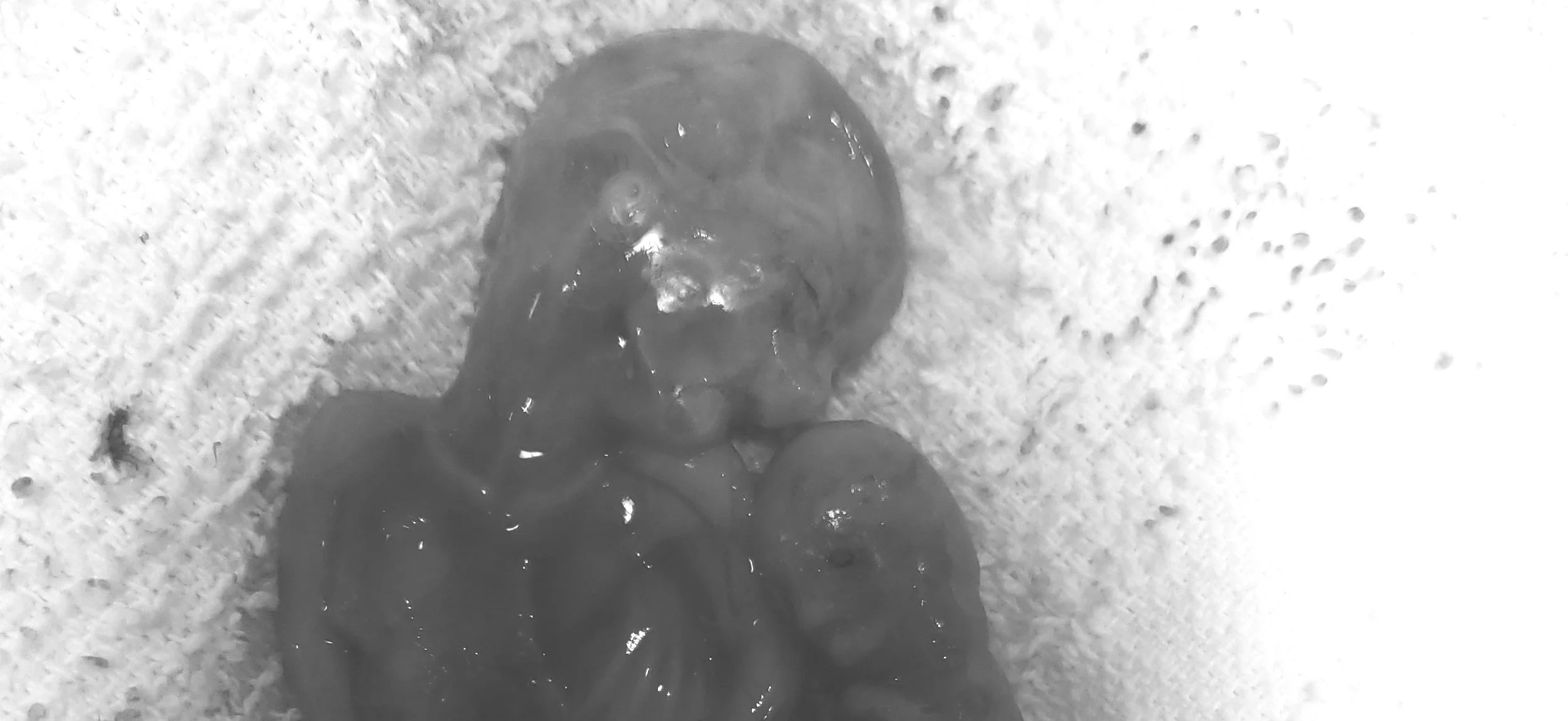 Kyler’s Beautiful Twin Boys
