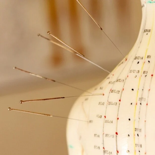 Wild Blue Acupuncture & Wellness, Louisville Colorado