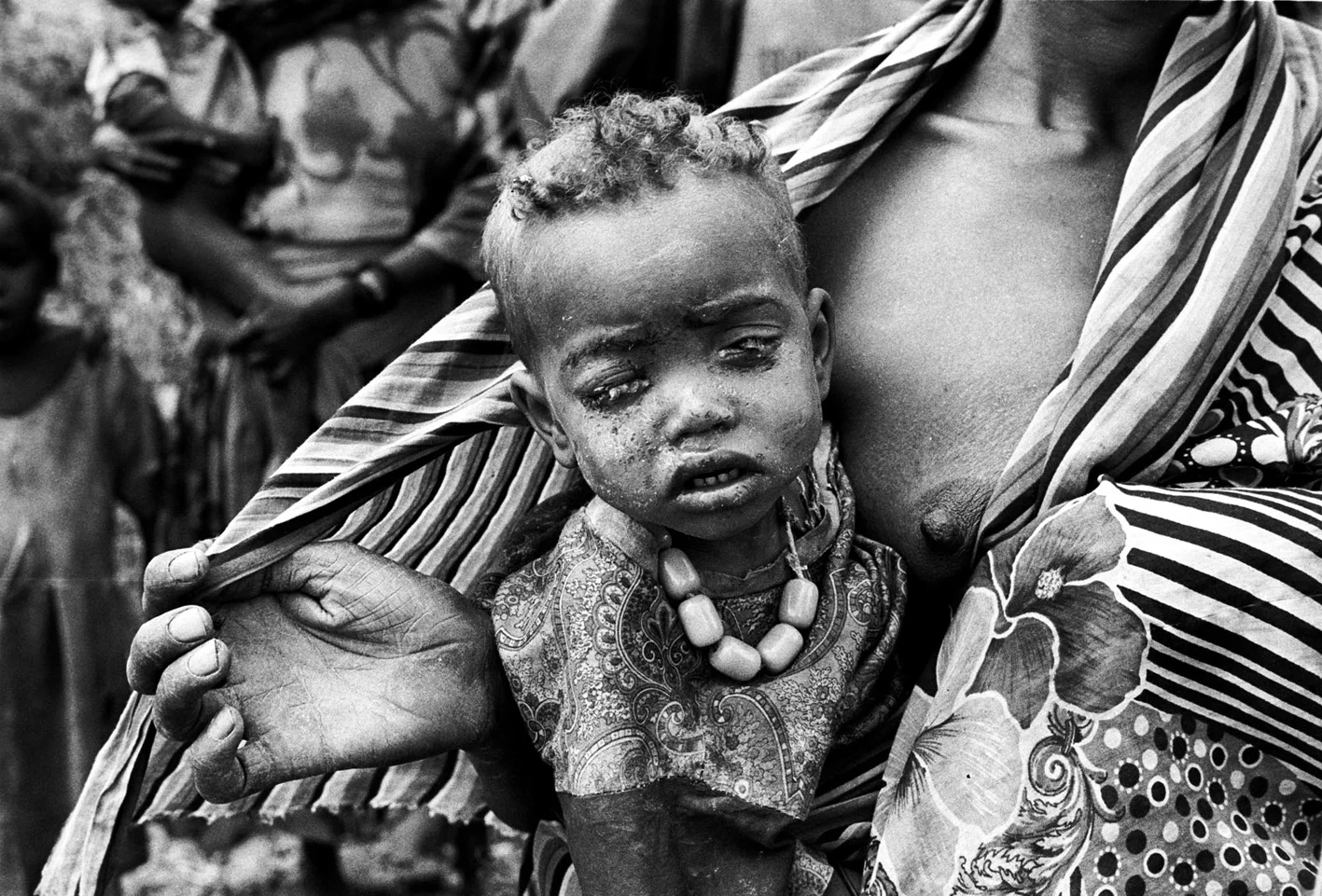 Food crisis, Ethiopia Leica M6