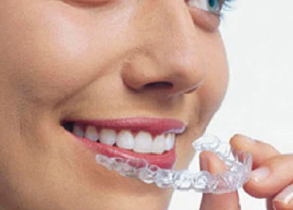 Invisalign