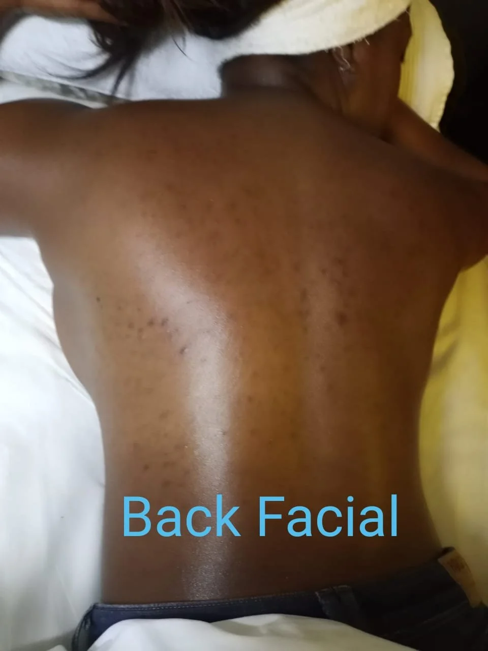 back facial.jpeg