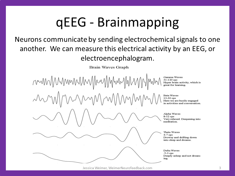 qEEG Neurofeedback Brainmapping