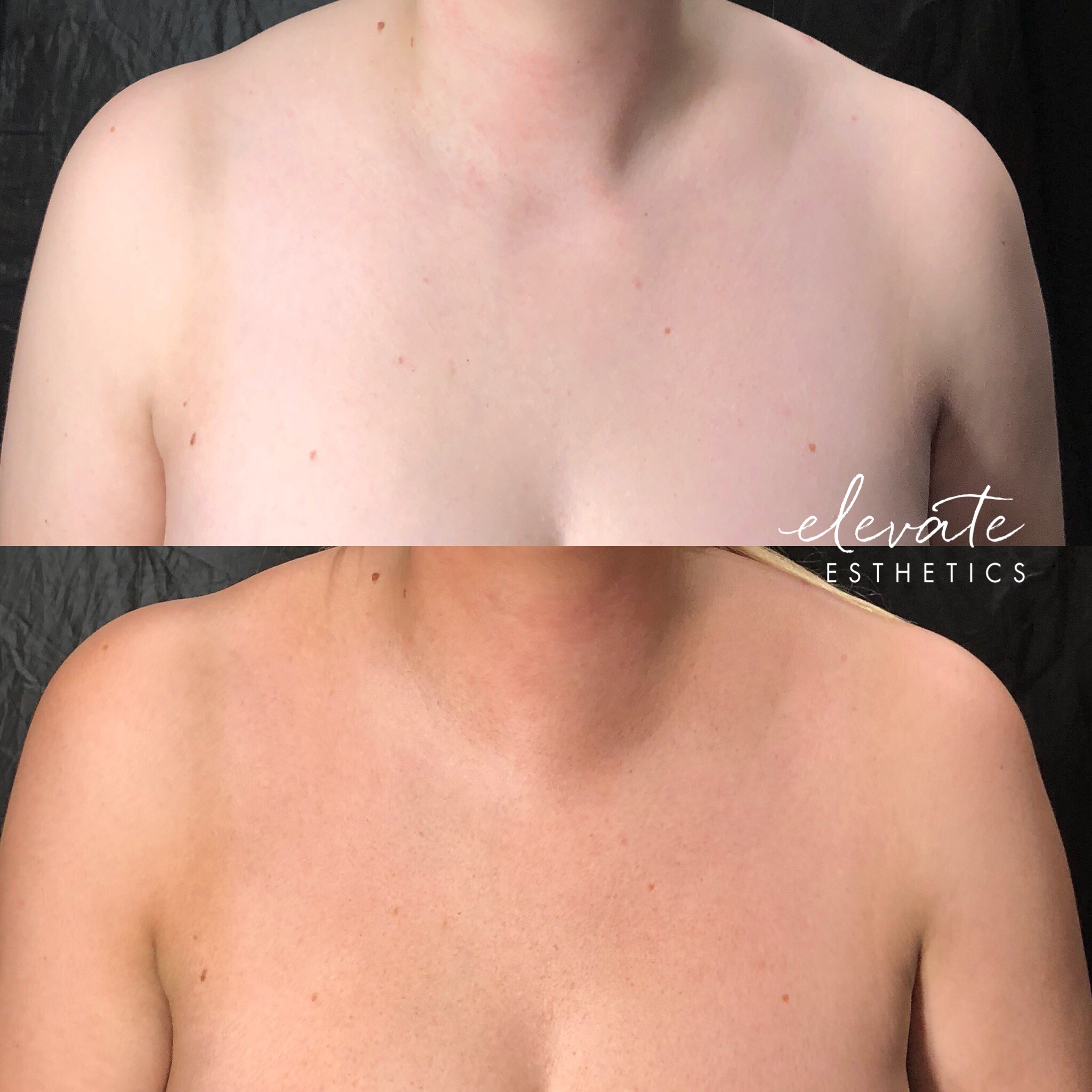 BEFORE_AFTER SPRAY TAN 2.PNG