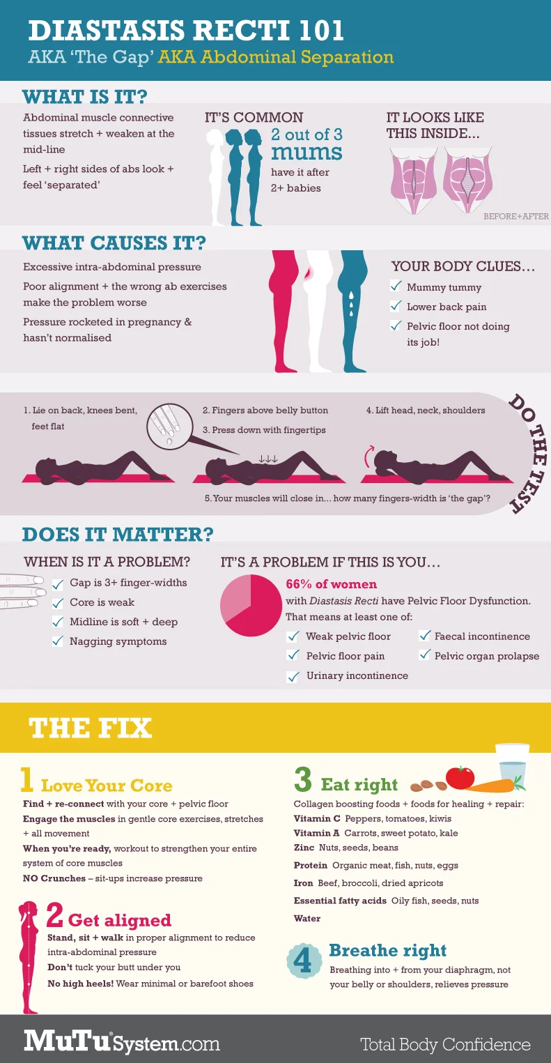 Diastasis101Web.jpg