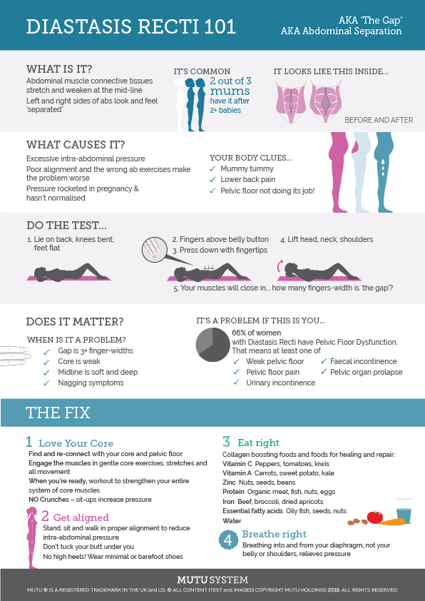 DIASTASIS101_INFOGRAPHIC_2019.png