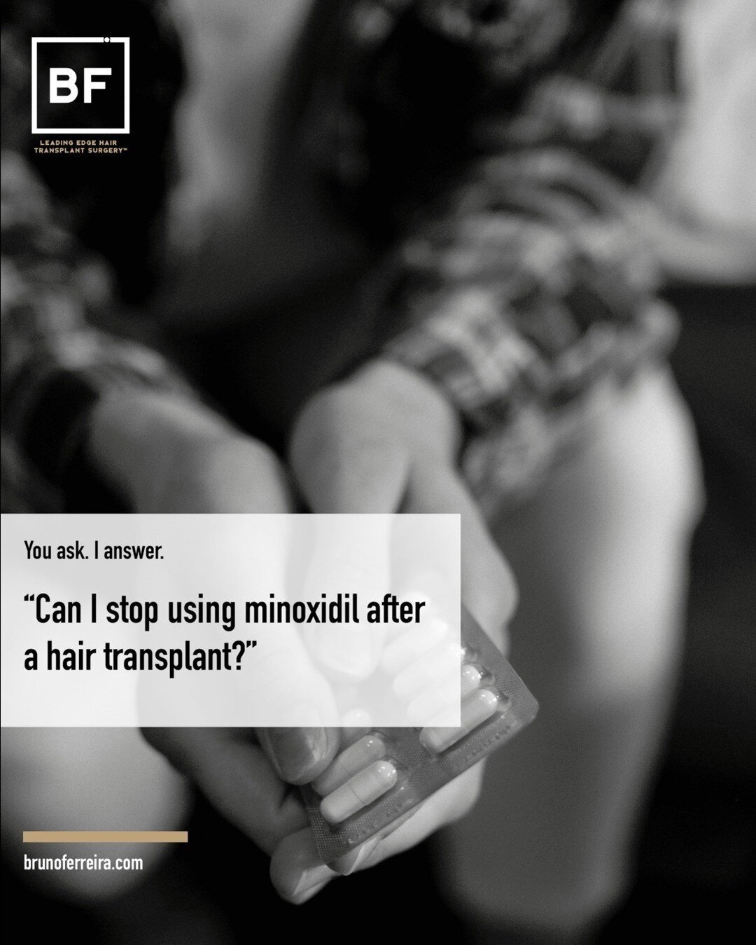 You can, but shouldn&rsquo;t do it in the first 10 months.
Why is that?
Because minoxidil affects the hair follicle cycle. We don&rsquo;t want to interfere with the hair cycle right after a hair transplant. We want to not change anything more, so kno