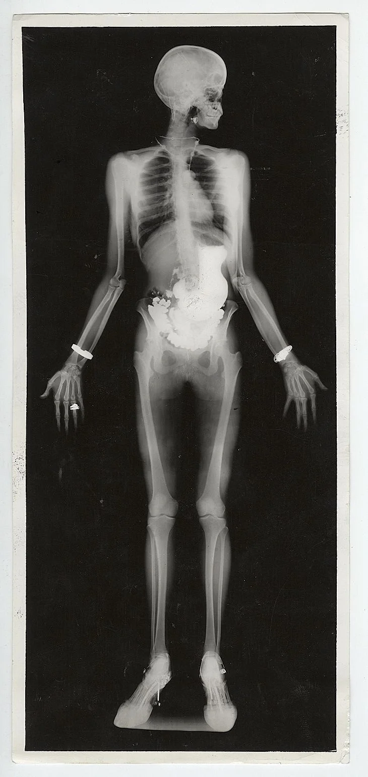Press Photograph, 1934