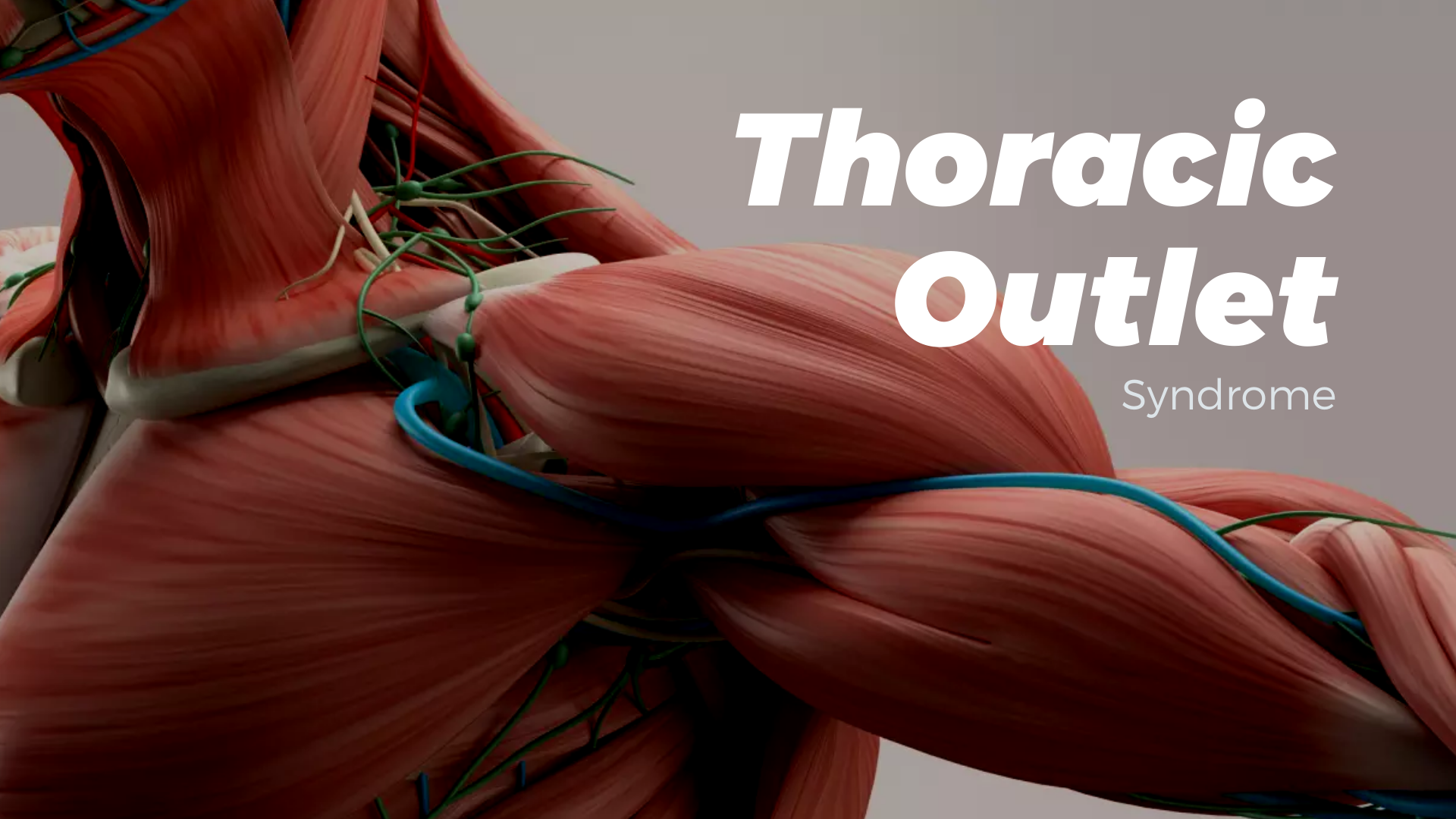 Thoracic-Outlet-Syndrom: Was Ist Es Und Behandlung – HZVAJ