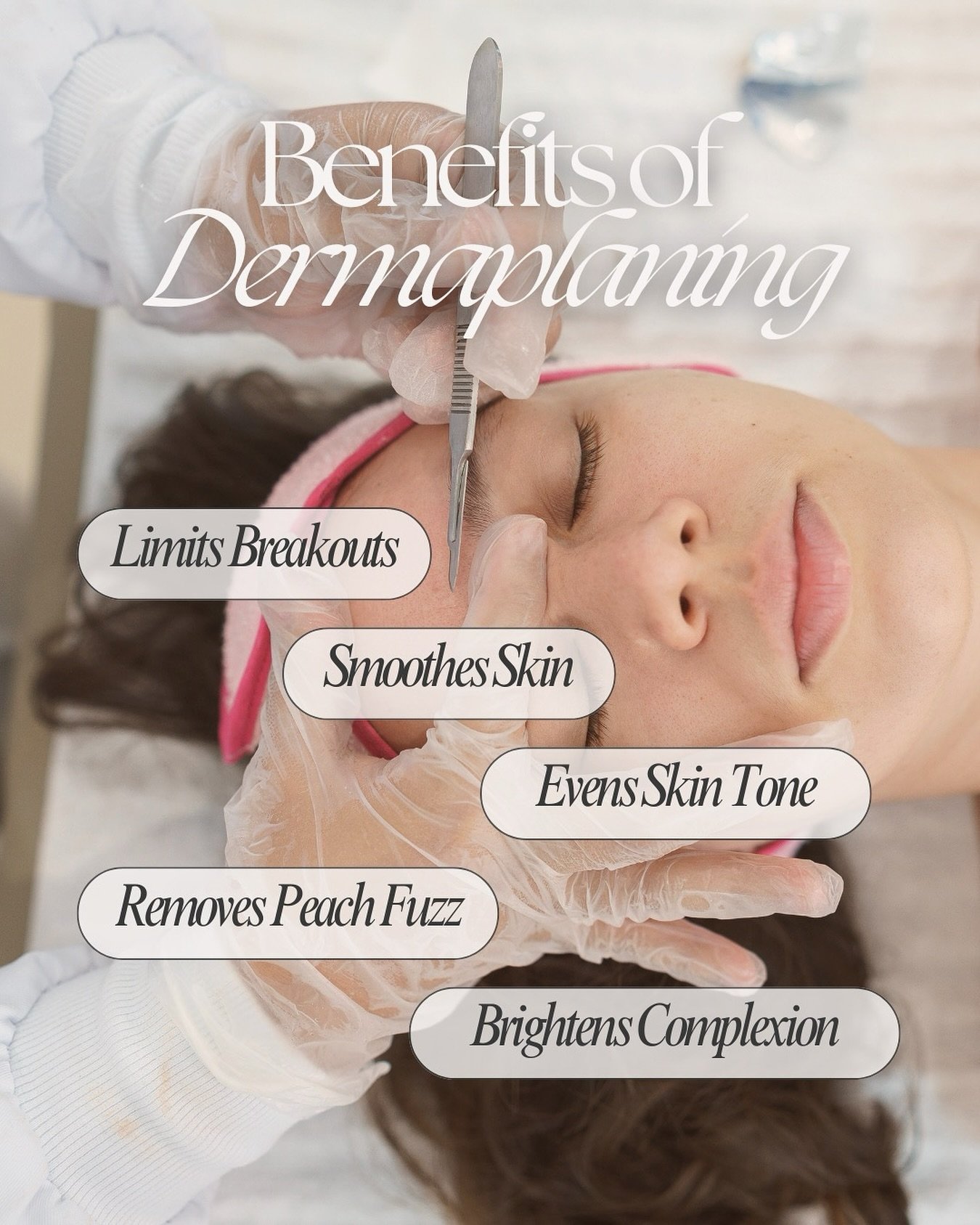 Reveal smoother, brighter skin with our dermaplaning treatments✨ This quick exfoliation removes 2 weeks&rsquo; worth of dead skin cells and peach fuzz, leaving your skin instantly refreshed and radiant. Perfect for in-between electrolysis sessions!

