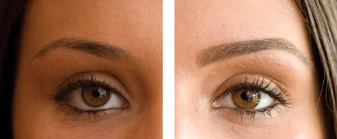 before-and-after-sophia.jpg