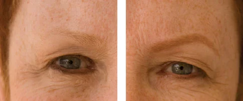 before-and-after-rita.jpg