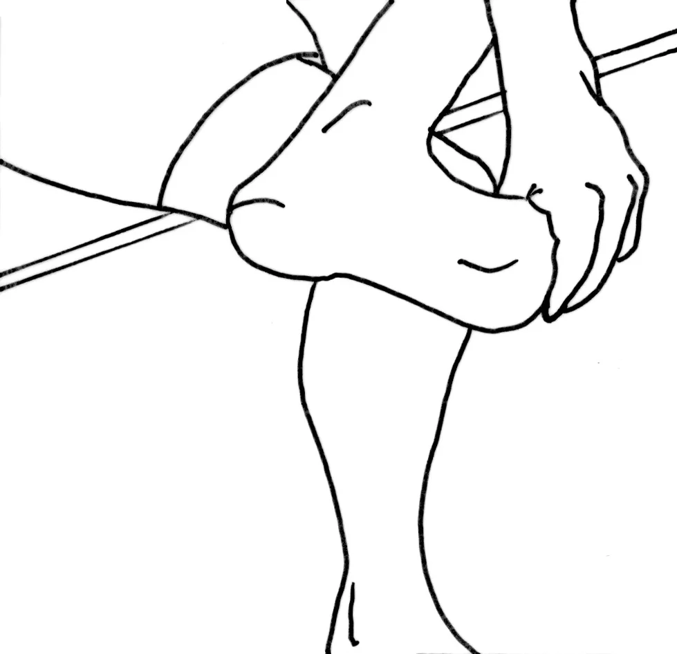 Fig 2.