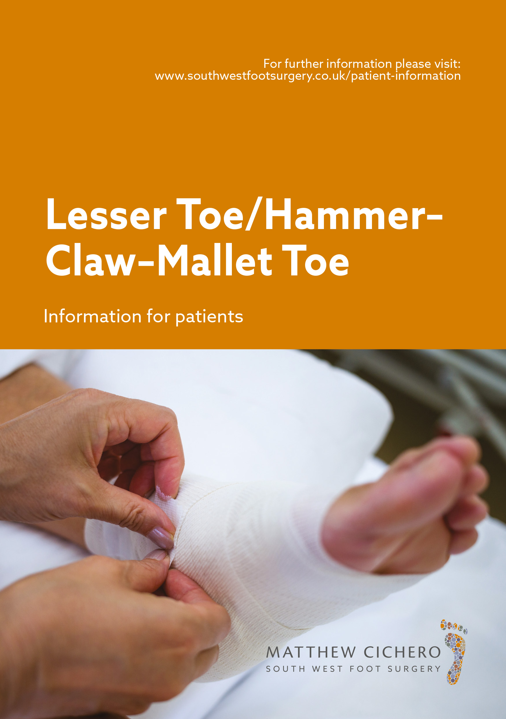 Lesser-Toe-Hammer-Claw-Mallet-Toe.jpg