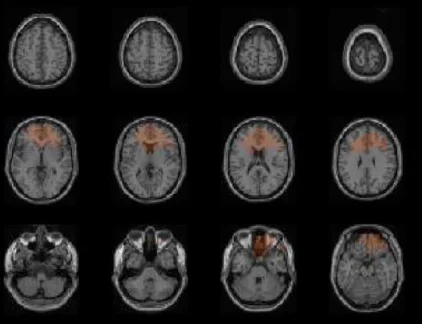 Brain Scan.jpg
