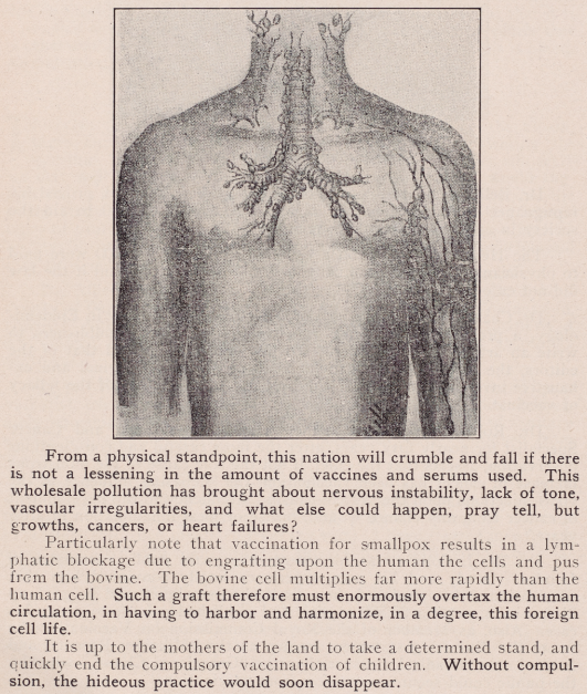 Image from Vaccination and Ruin , published by the New York Anti-Vivisection Society, 1916.