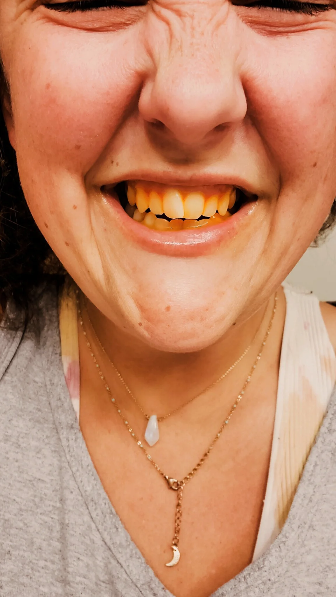 How To Whiten Teeth Naturally