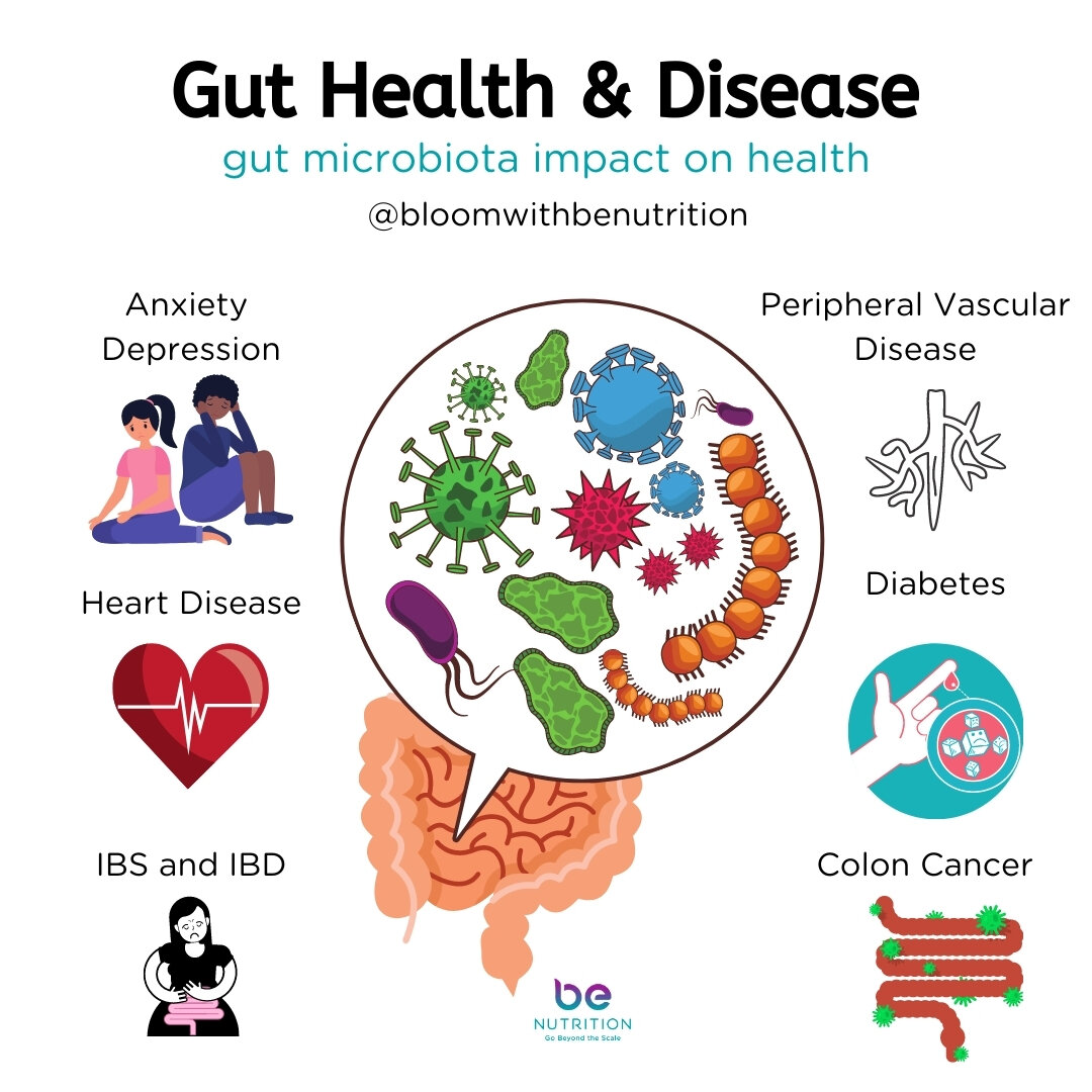 Link between gut health and disease