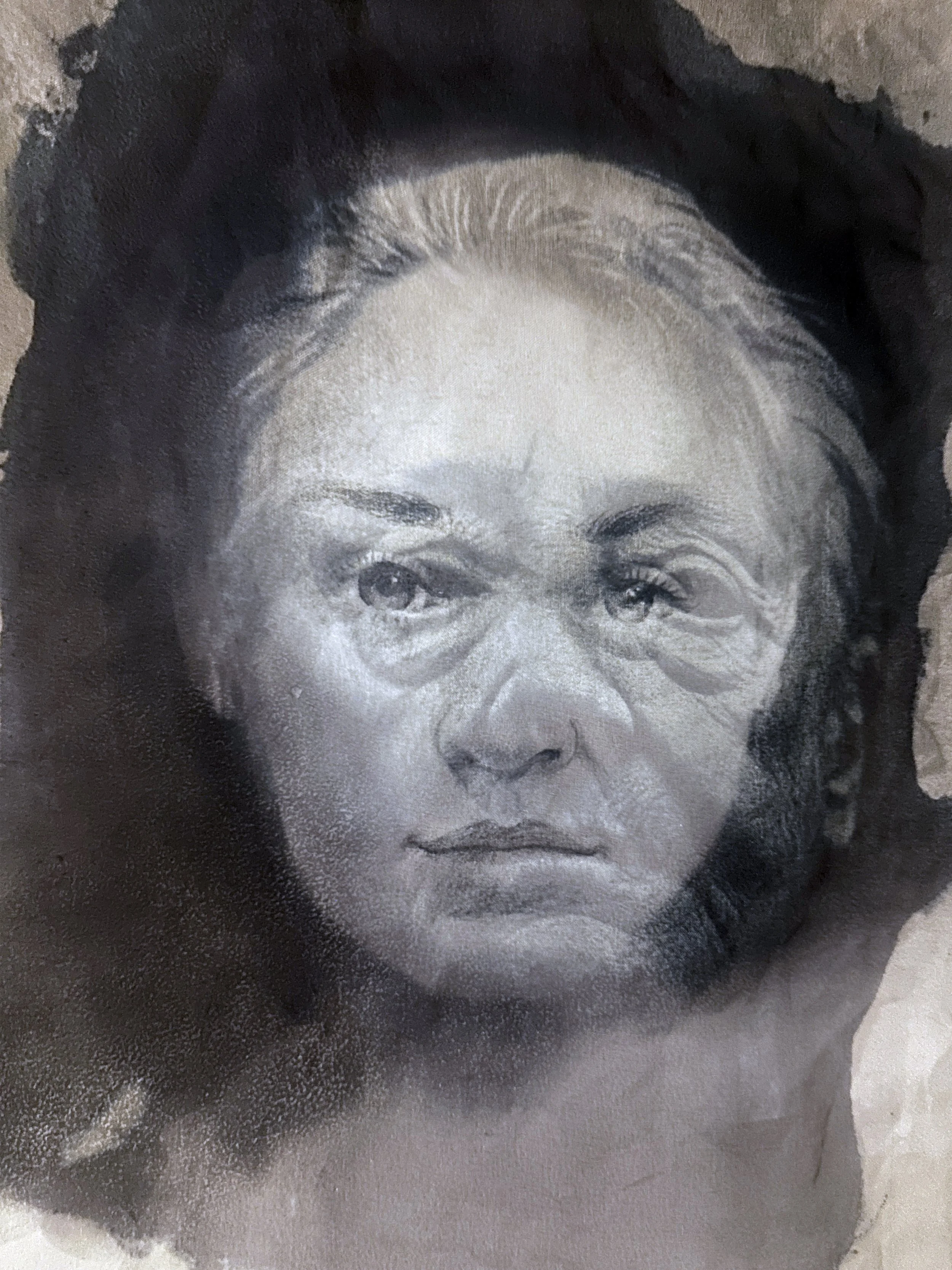 Fig 027-A (Young) Fig 027-B (Aged) Subject: Racheal