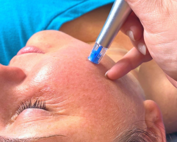 Rezenerate™ Facial Treatments May Be the “Best. Facial. Ever.”