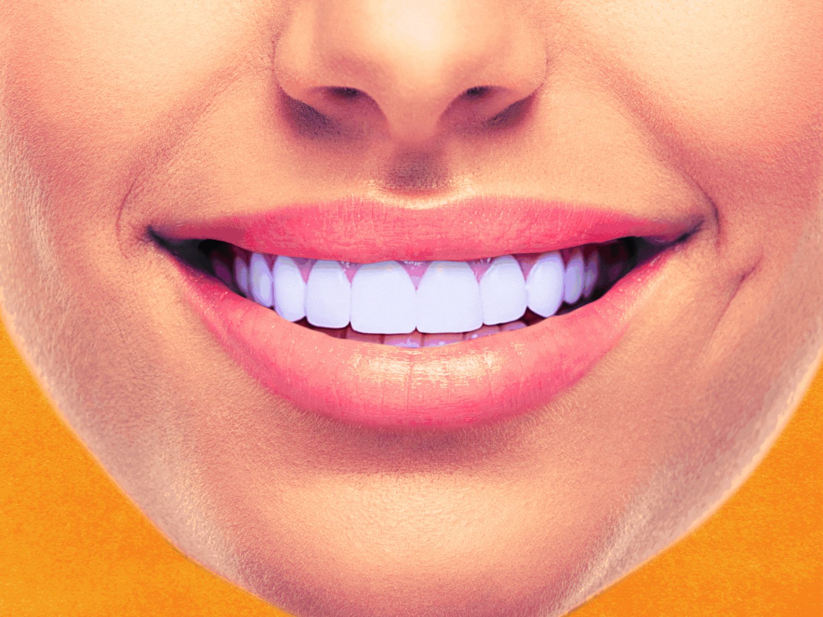 The Cost of a Perfect Smile