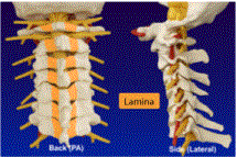 acdf_clip_clip_image002.gif