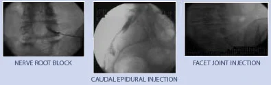nonoperative-bottom_07.jpg