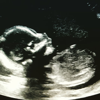 Baby #4 - due March 2017
