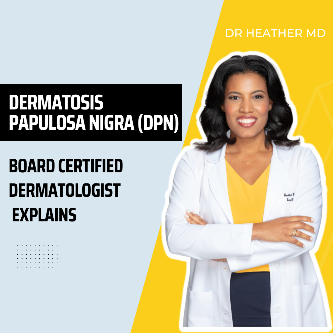 Dermatosis Papulosa Nigra (DPN)