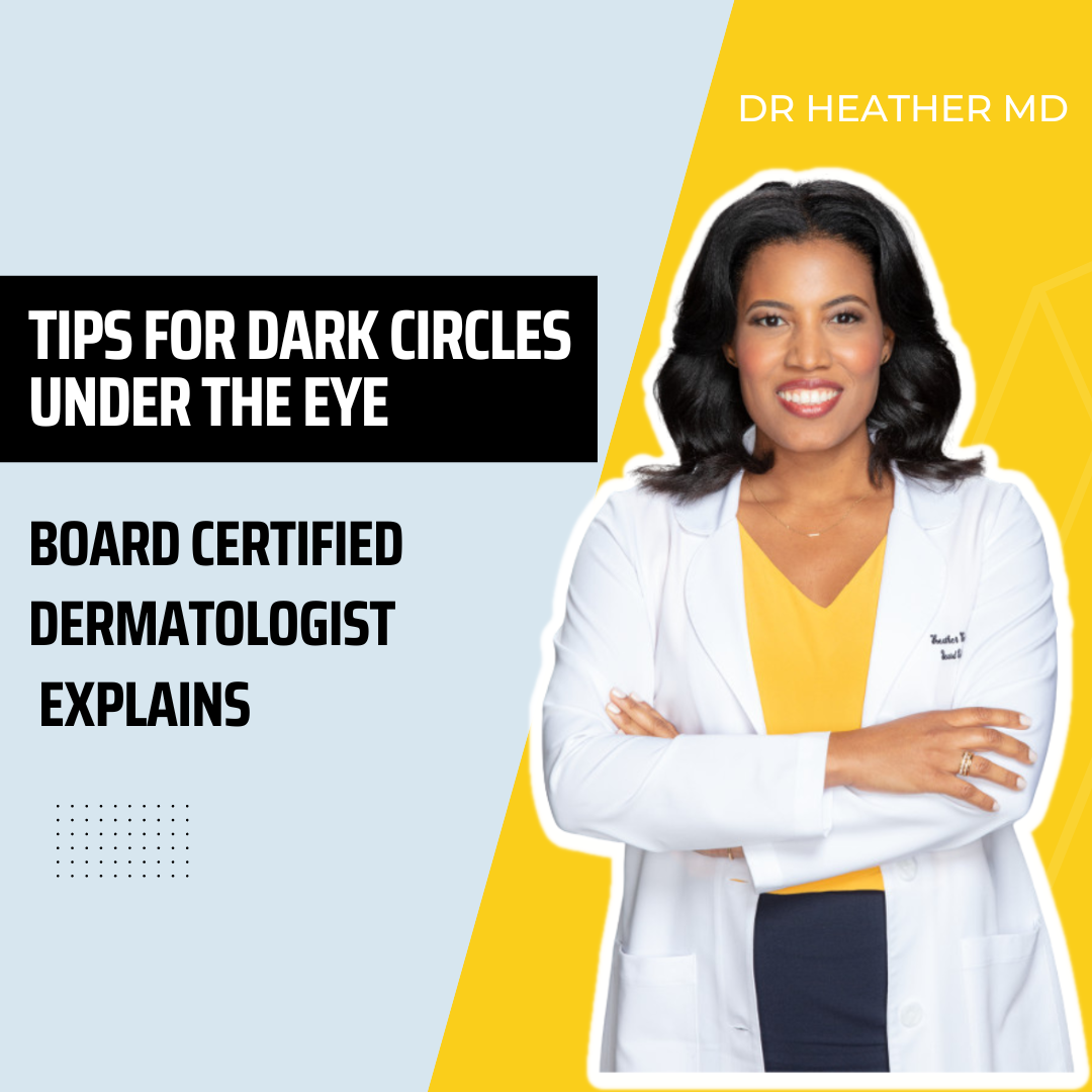 Tips For Dark Circles Under The Eye
