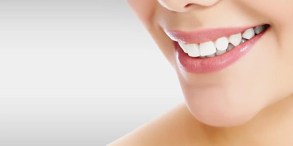 Cosmetic Teeth Whitening 275 90 minutes Bleach Bright — Sphere Medi Spa