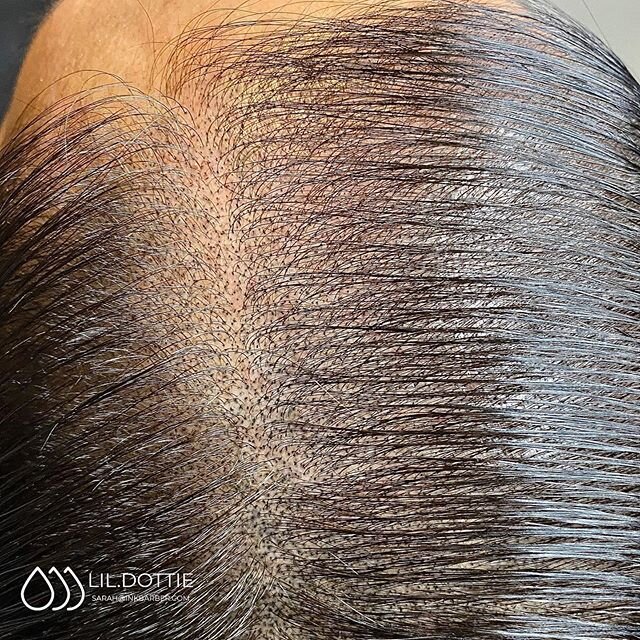 The power of the dot. They may be small but they are mighty 💪💪💪
&bull;
&bull;
&bull;
SMP can do wonders for your thinning hairline. It minimizes the contrast between the hair and scalp. Have more questions? Email me today ✌️ sarah@inkbarber.com