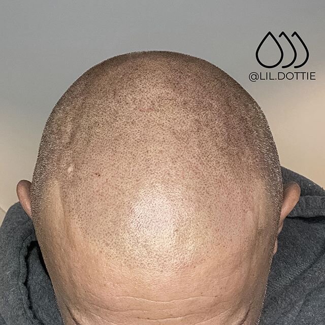 Don&rsquo;t mind him, he just came in for a hairline. &bull;
&bull;
&bull;
Already looking 🔥 and still another session to go. &bull;
&bull;
&bull;
Email me today at sarah@inkbarber.com if your hair situation needs some love 🖤