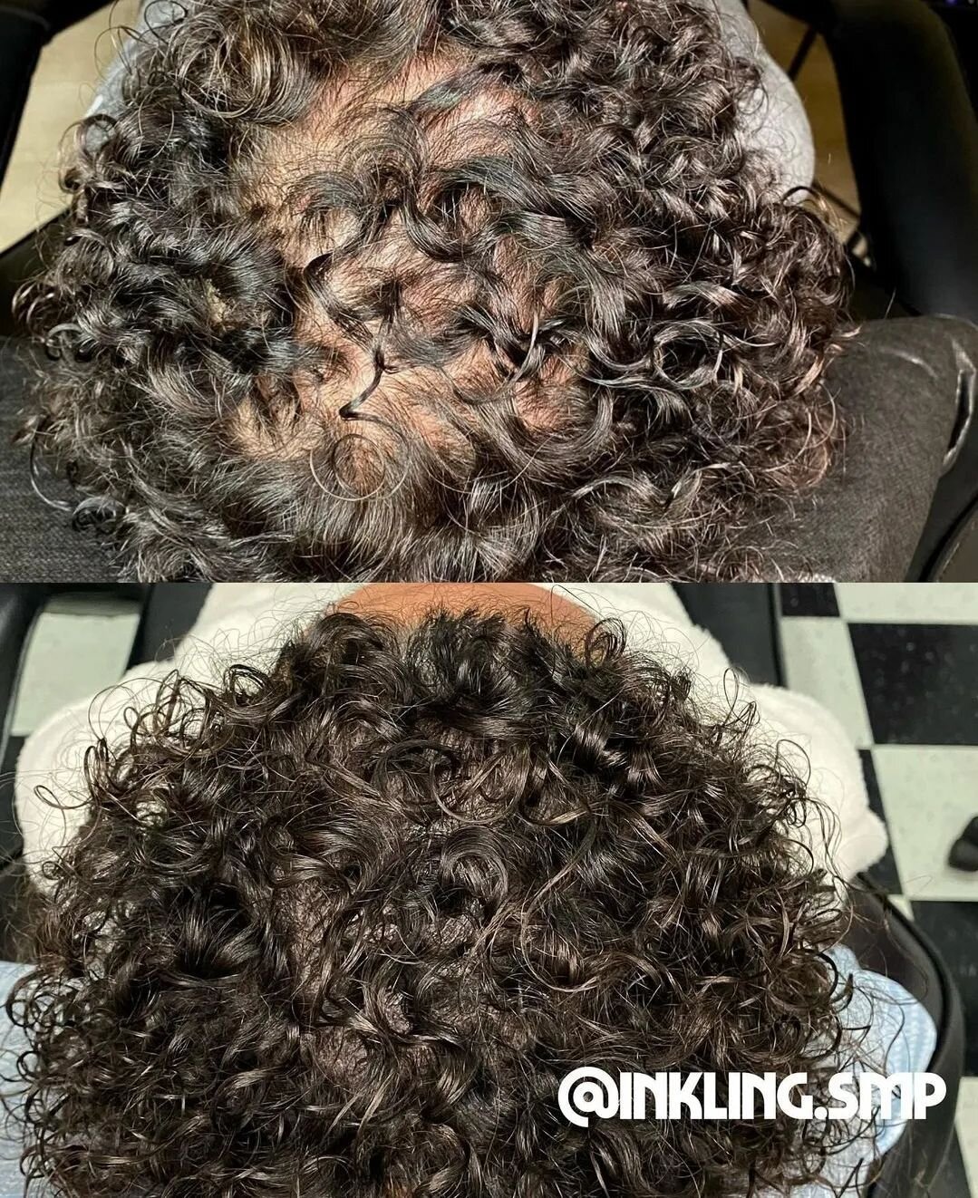 😮!!! Density awesomeness by @inkling.smp. Whenever you see us posting whether it's density work or a shaved head, we are posting real results, cleaned down and as honest as possible. 
.
#scalpmicropigmentation #hairdensity #hairlosssolution #curls #