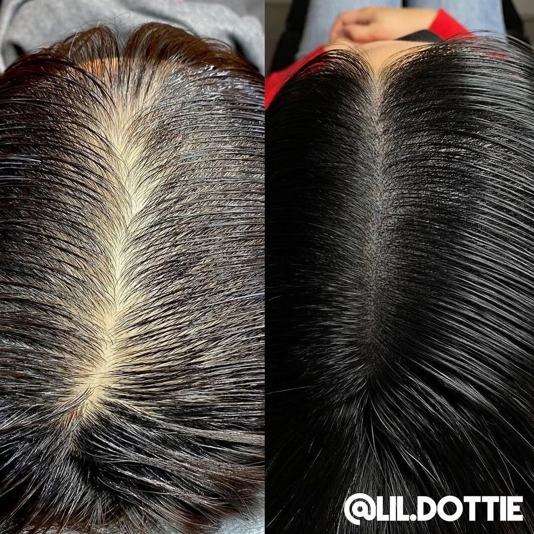 @lil.dottie making people thicc where it counts. 🙌🙌
.
Book now at  INKBARBER.COM
.
#thicc #smp #thickhair #scalpmicropigmentation #scalp #tattoo #hairtattoo #hairline #part