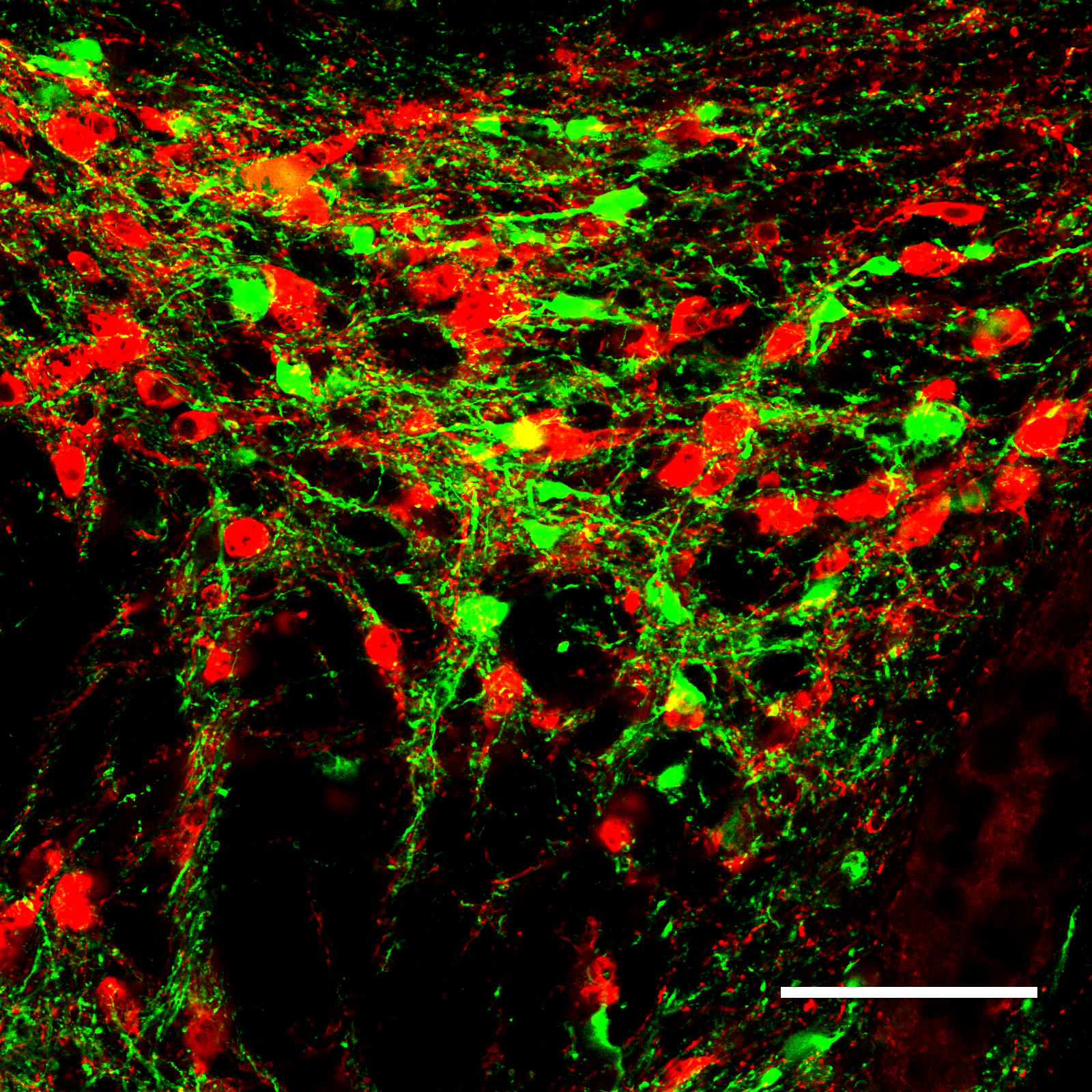 GABAergic (green) neurons in the VTA are intermingled with TH+ (red) neurons