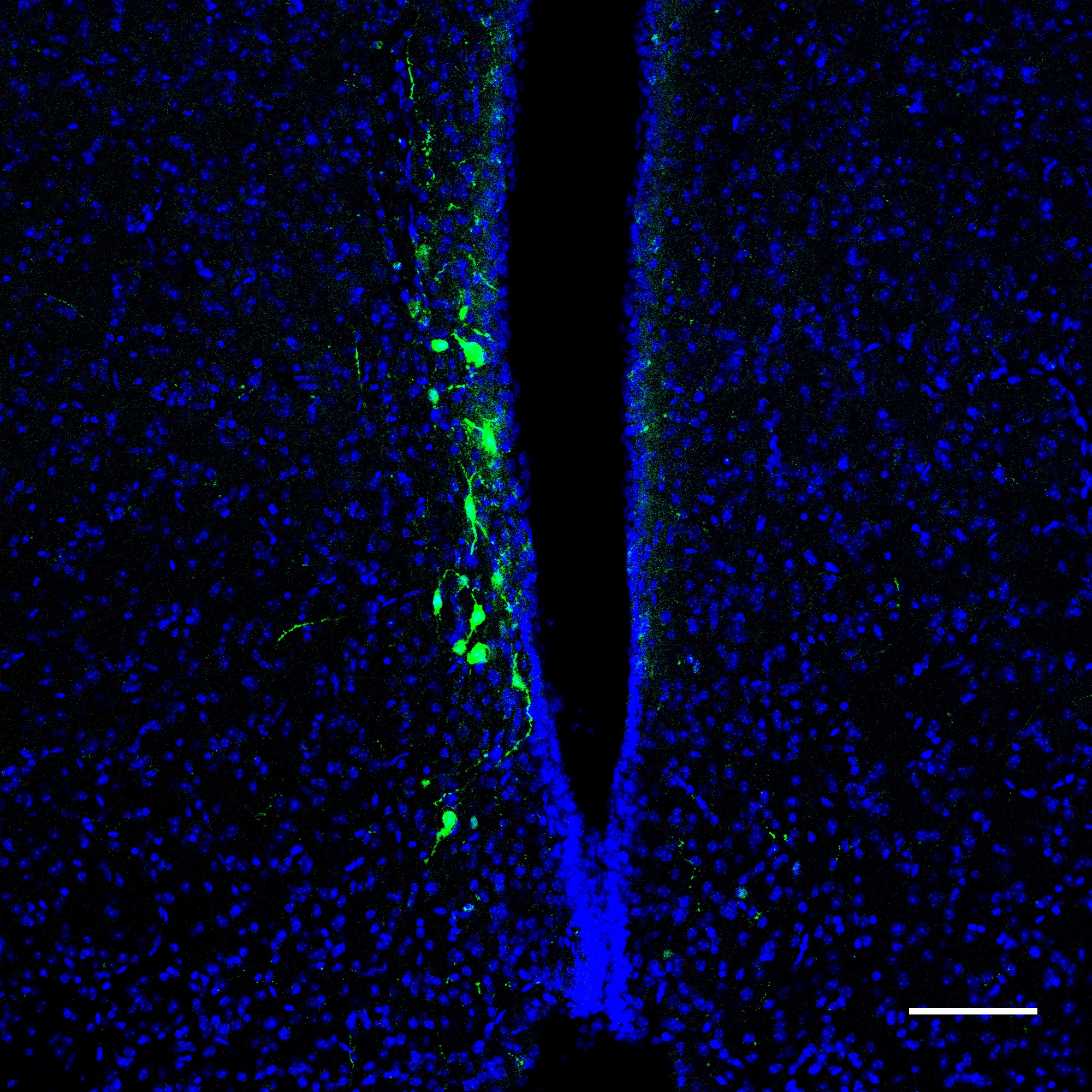 Circuit tracing using rAAV2-retro GFP identifies neurons projecting to sleep/wake regulatory regions 