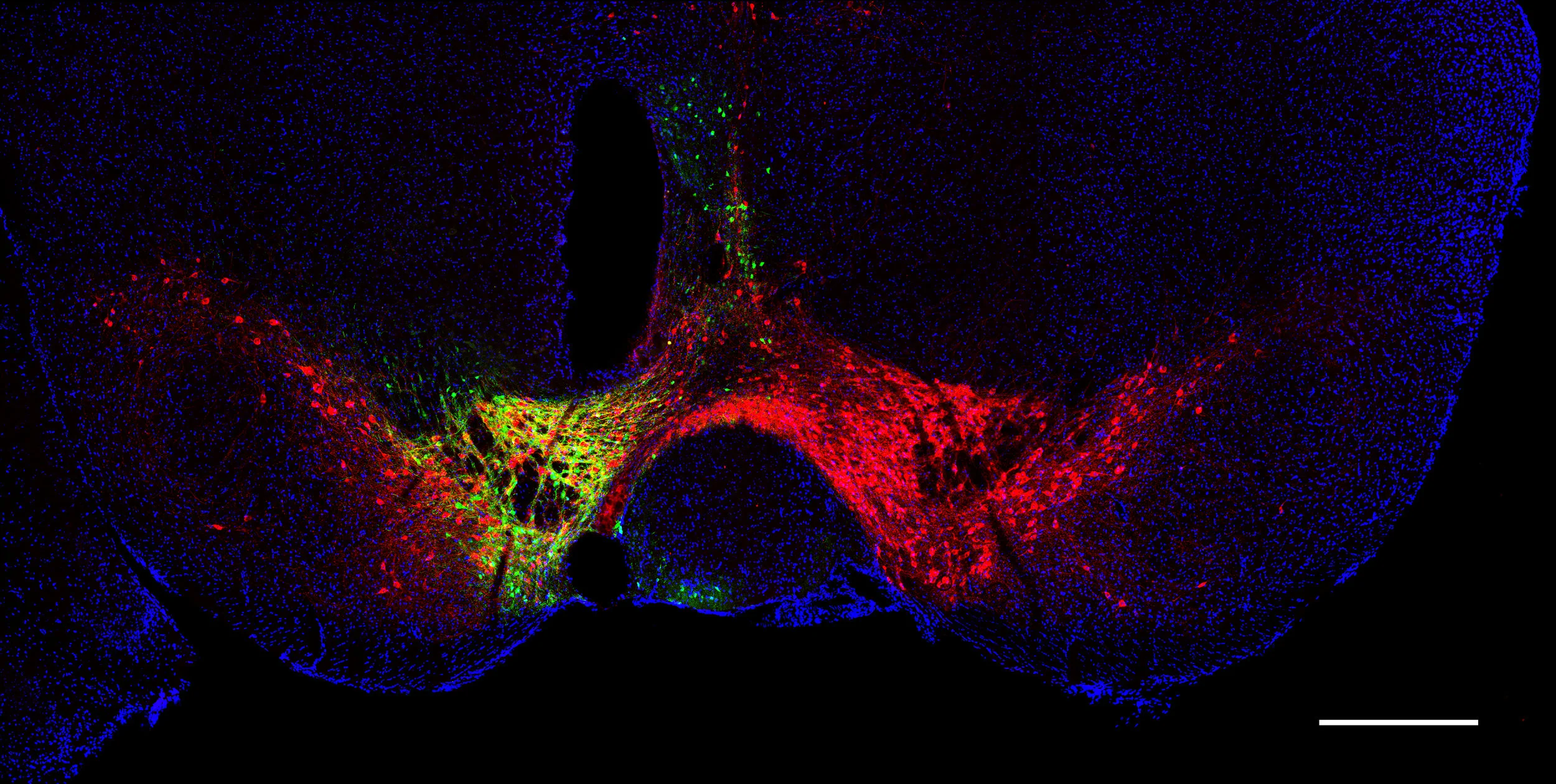 Fiber photometry track above the VTA