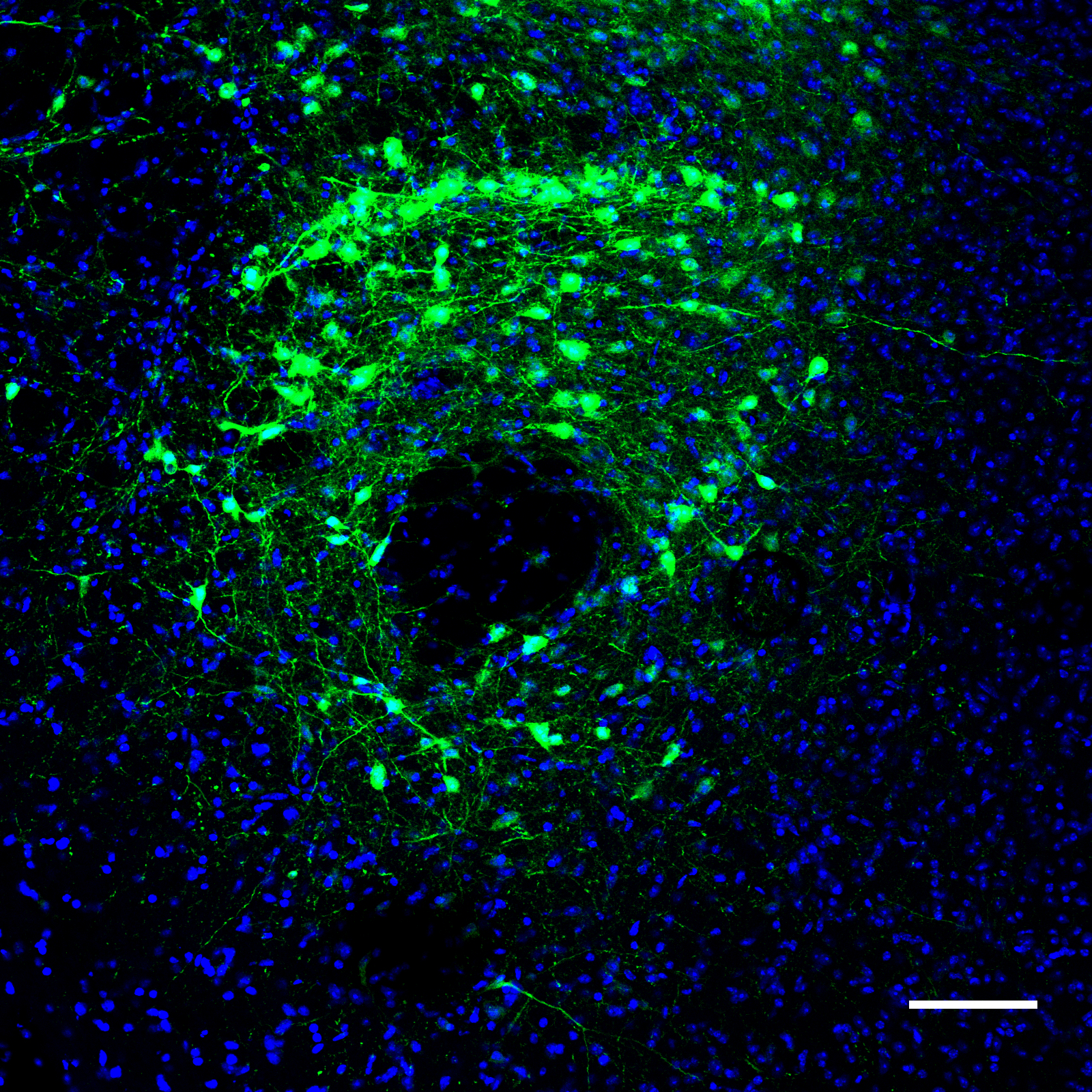 GCaMP6s expression in GABAergic neurons of the LH