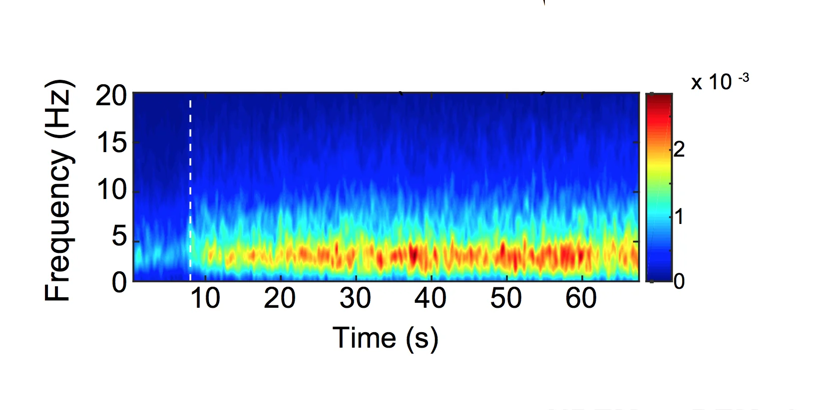 EEG spectrogram during a wake-to-NREM sleep transition