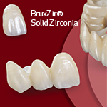 BruxZir® Solid Zirconia.png