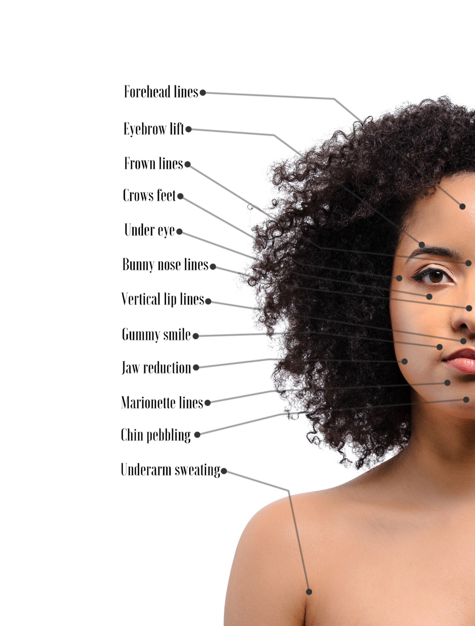 Anti Wrinkle Injections Diagram.jpg