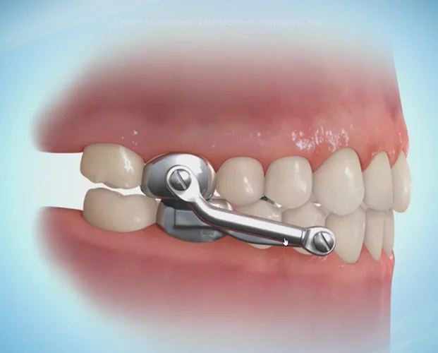 jorgensen orthodontics