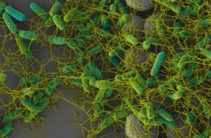 E Coli attached to rough surface with biofilm formation