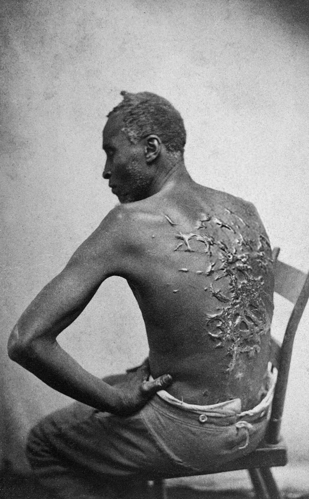 101 Scourged_back_by_McPherson_&_Oliver,_1863,_retouched.jpg