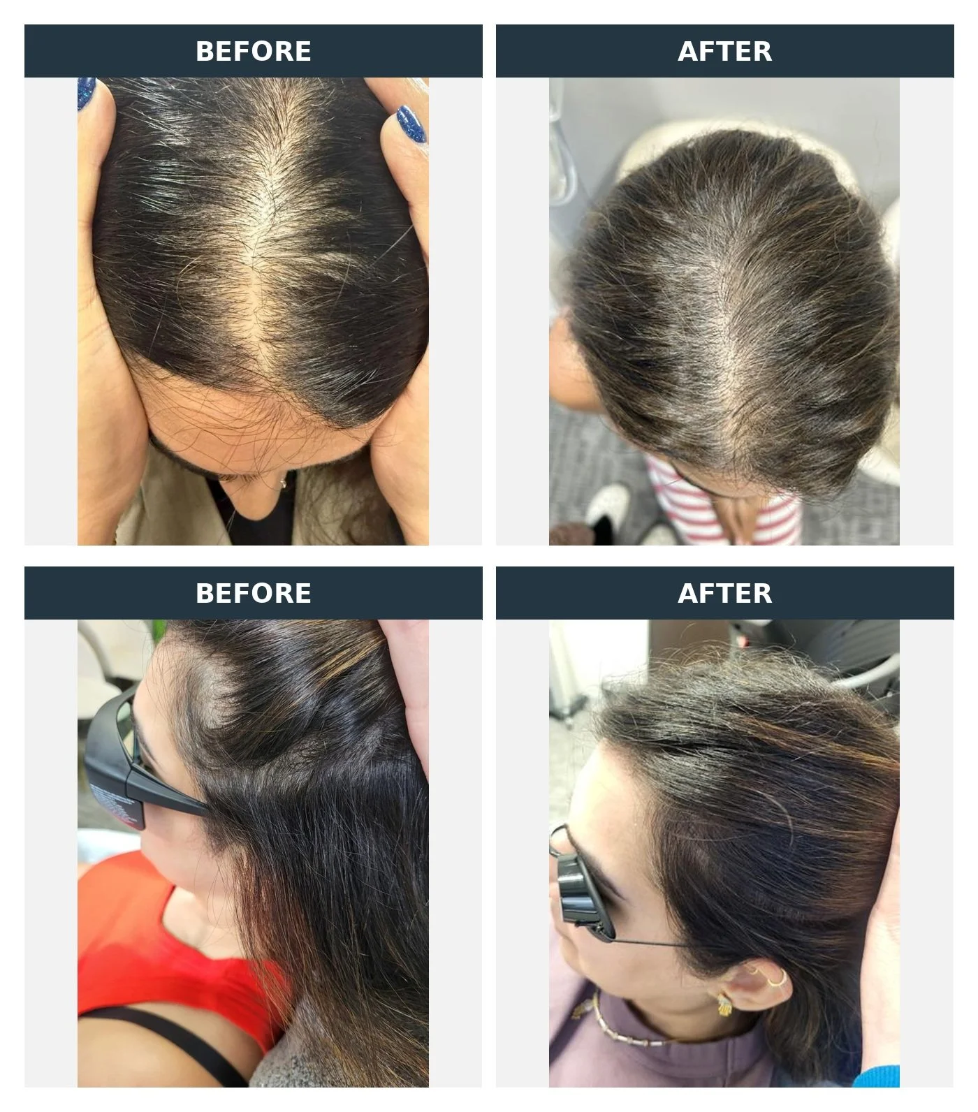 hair_before_after_comparison.jpg