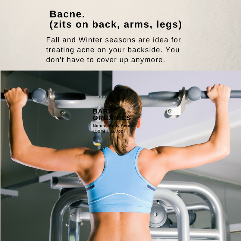 Before spring and summer brings on bare arms and backs, let’s work on cleaning up acne on the back! Peels, Microdermabrasion, and extractions will help clear up breakouts.