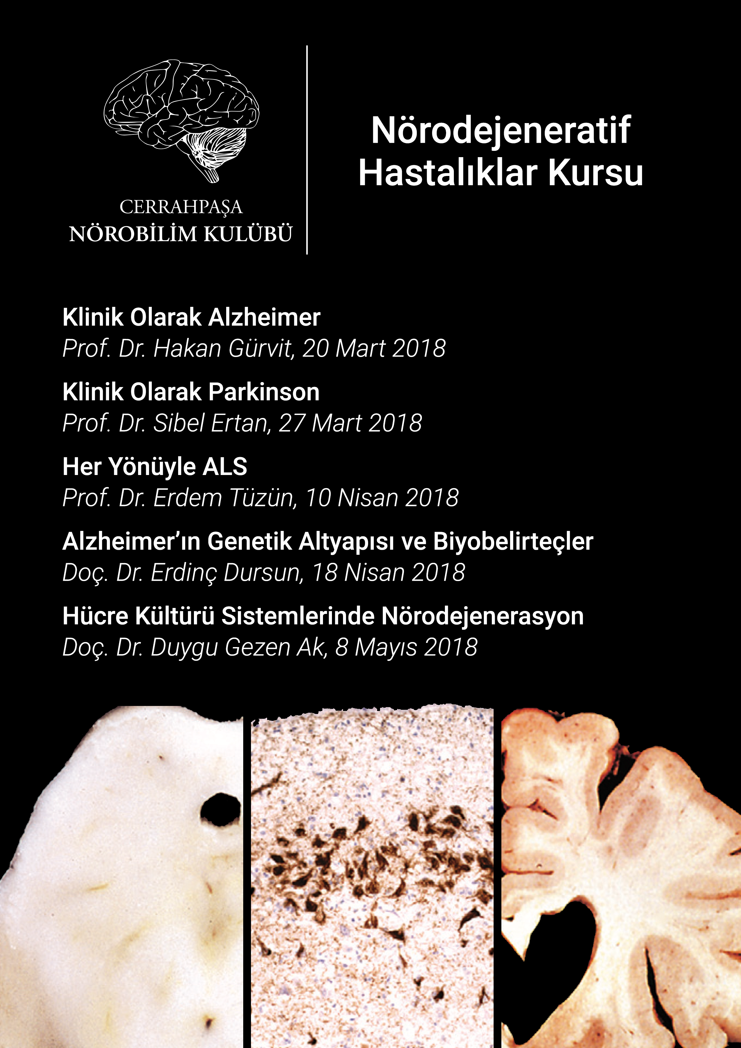 nörodejeneratifhastalıklarkursu.png